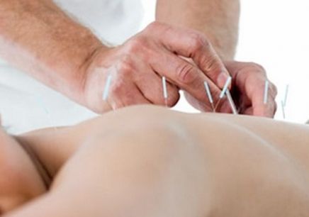 中醫(yī)學(xué)-中醫(yī)針灸