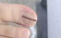 中醫(yī)學(xué)從指甲查病因【全】