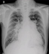 醫(yī)學(xué)影像技術(shù)未來的發(fā)展