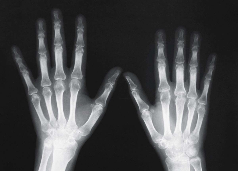 醫(yī)學(xué)影像學(xué)——X線