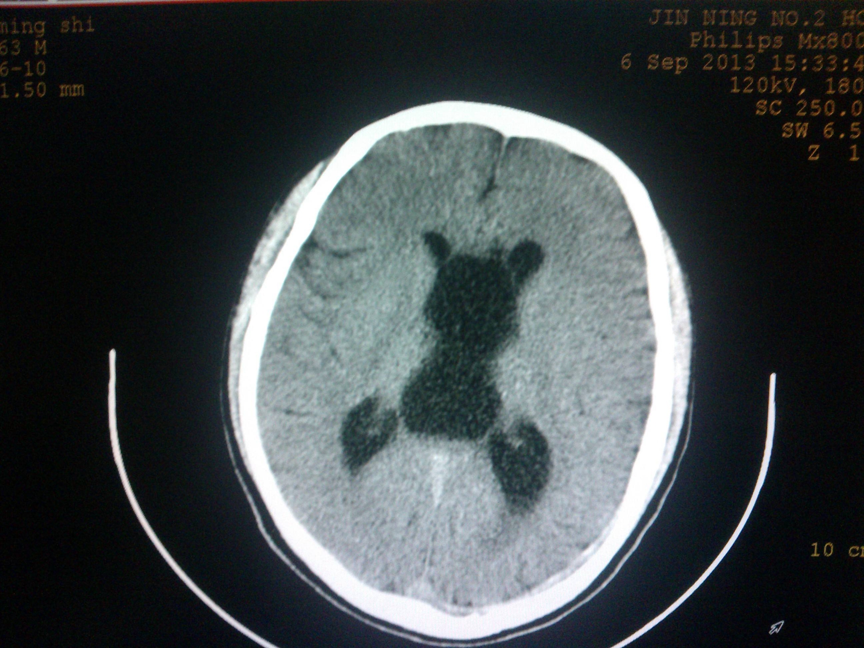 醫(yī)學(xué)影像學(xué)練習(xí)題