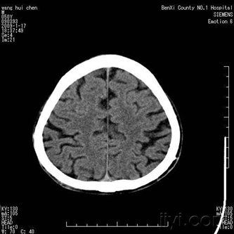 醫(yī)學(xué)影像學(xué)練習(xí)題