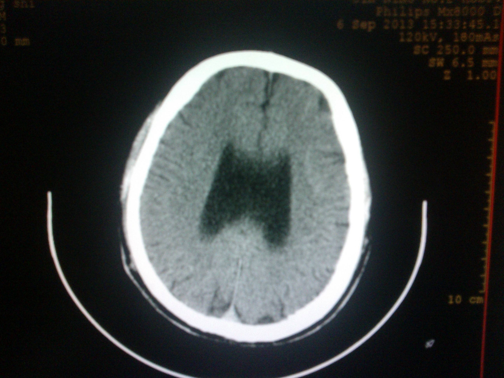 醫(yī)學影像學相關(guān)知識