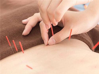 針灸減肥的誤區(qū)
