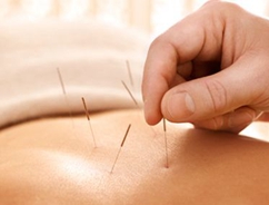 中醫(yī)針灸法的特點(diǎn)【全】