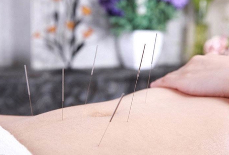 針灸推拿專業(yè)屬于中醫(yī)學(xué)專業(yè)嗎