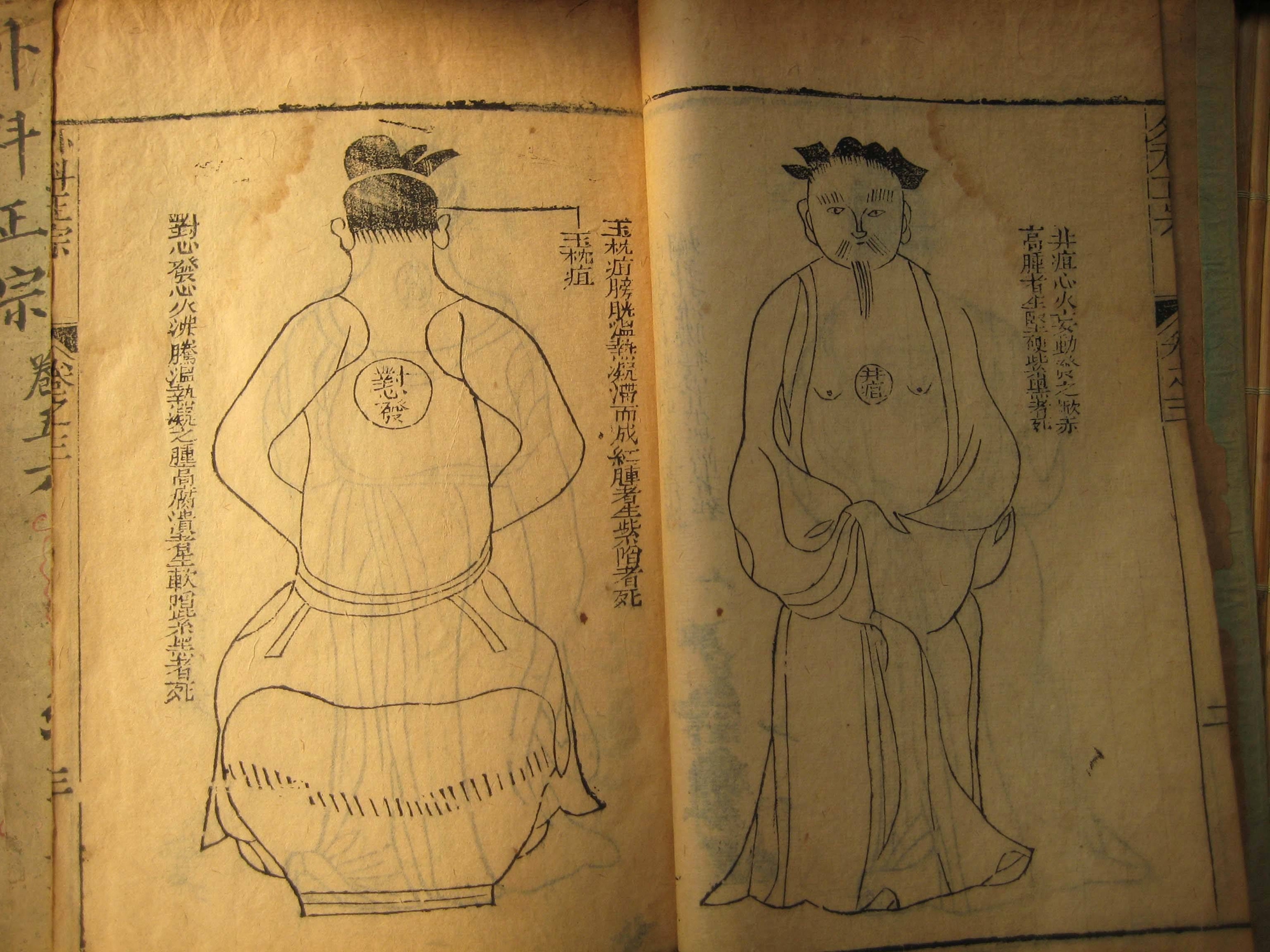 中醫(yī)學(xué)專業(yè)必看的書籍