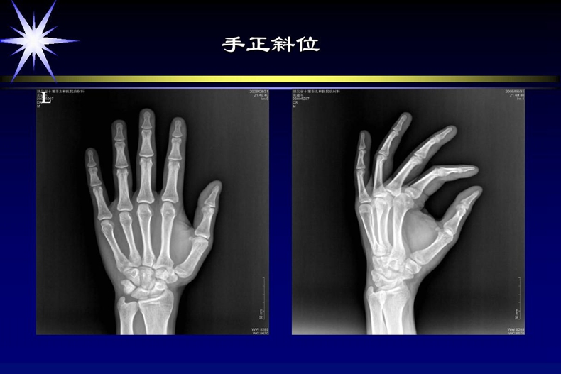 中醫(yī)藥大學(xué)針灸學(xué)校